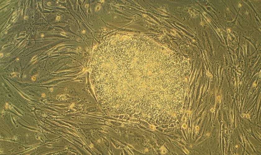 Image shows a human stem cell.